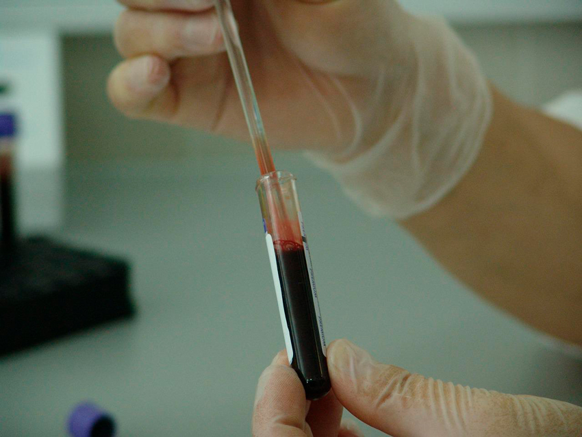 análisis sangre